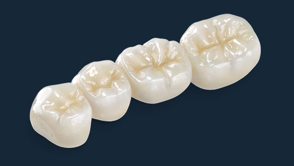 BruxZir Full Strength Bridge