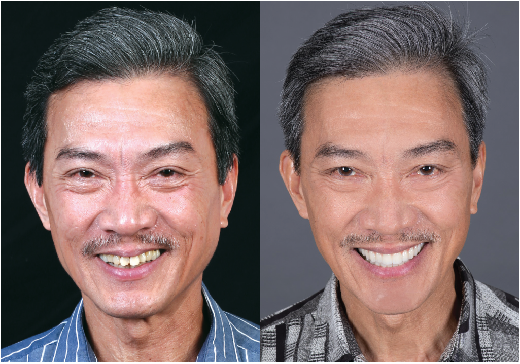 Male Patient's before and after