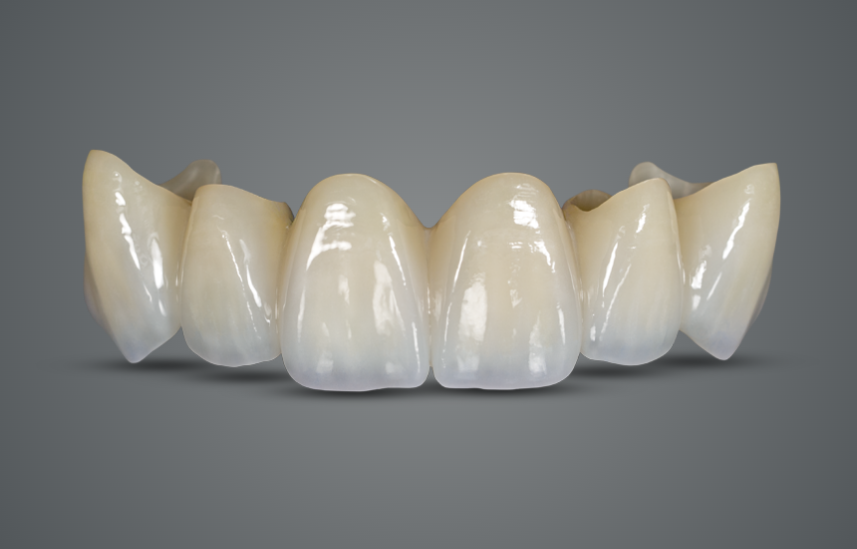 BruxZir Esthetic Zirconia