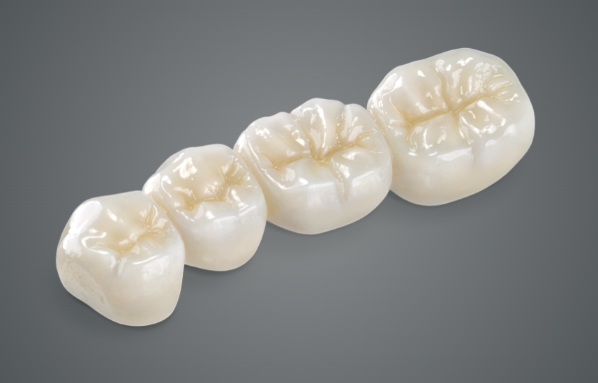 BruxZir Full-Strength Zirconia