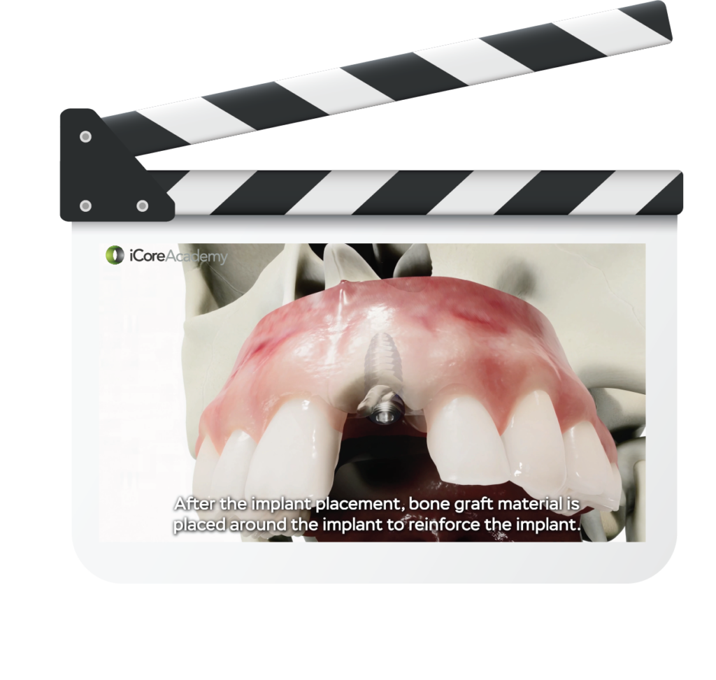 Put the Power of Hollywood 3D Animation in Your Patient's Hand